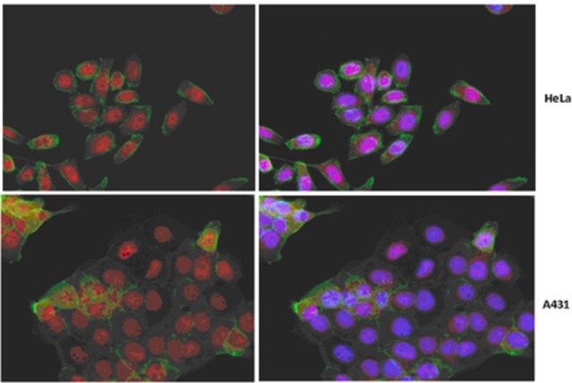 Anti-Yes-associated protein (YAP1) Antibody, clone 4D11.1