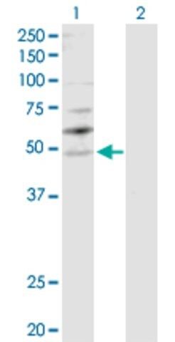 Anti-YBX2 antibody produced in rabbit