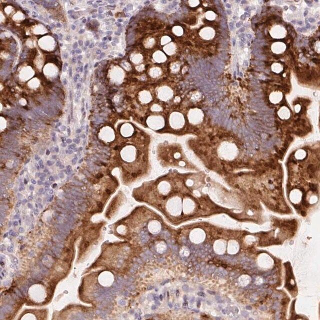 Anti-YIF1B antibody produced in rabbit