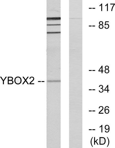 Anti-YBOX2 antibody produced in rabbit