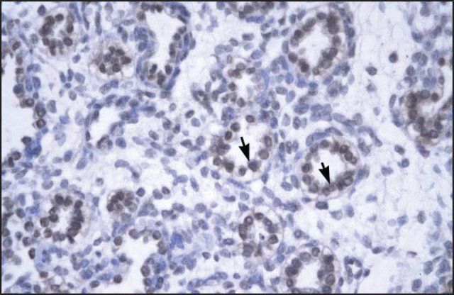 Anti-YEATS4 antibody produced in rabbit