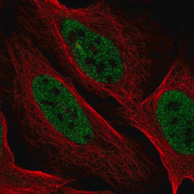 Anti-YDJC antibody produced in rabbit