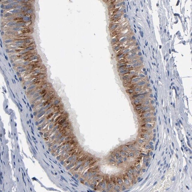 Anti-YIPF6 antibody produced in rabbit