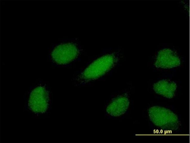 Anti-YEATS4 antibody produced in mouse