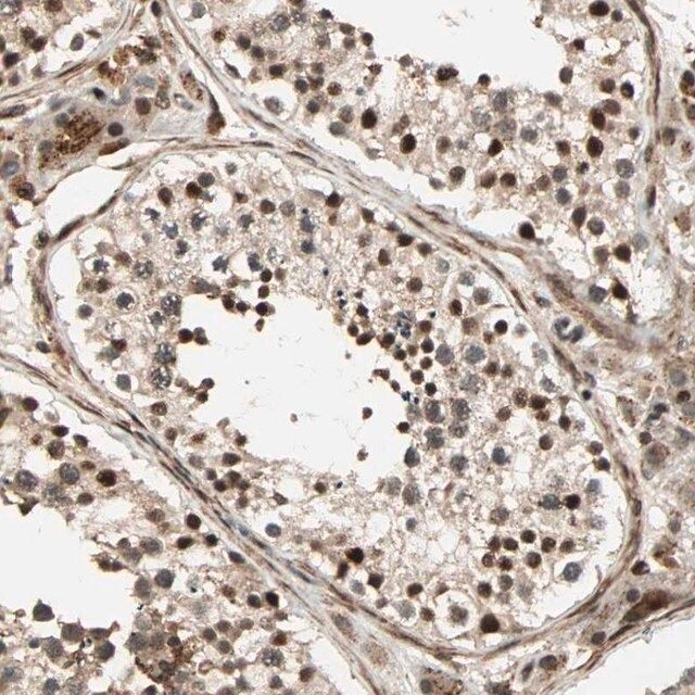 Anti-ZBED9 antibody produced in rabbit