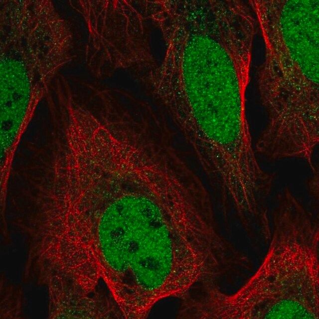 Anti-YEATS4 antibody produced in rabbit