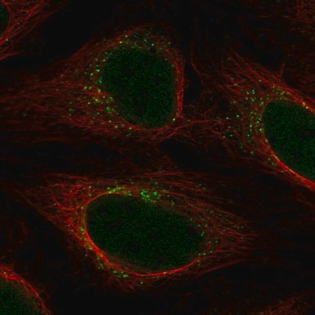 Anti-YIPF5 antibody produced in rabbit