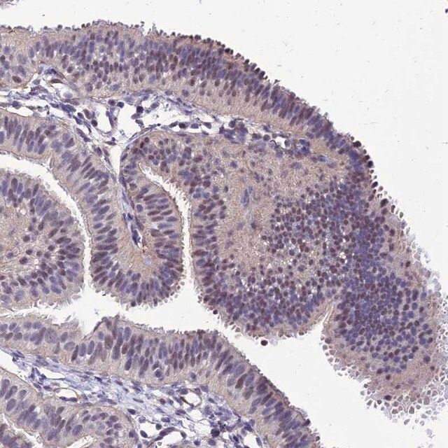 Anti-YEATS2 antibody produced in rabbit