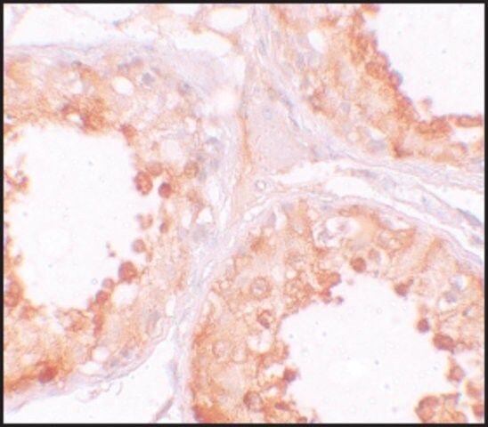 Anti-YBX2 antibody produced in rabbit