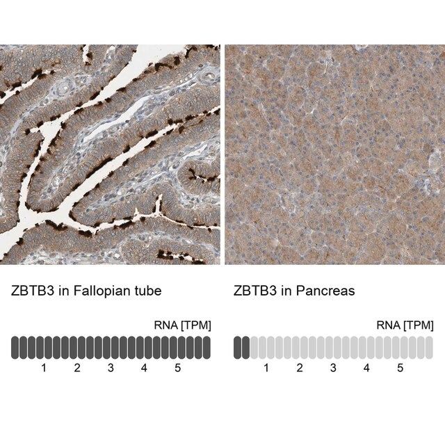 Anti-ZBTB3 antibody produced in rabbit