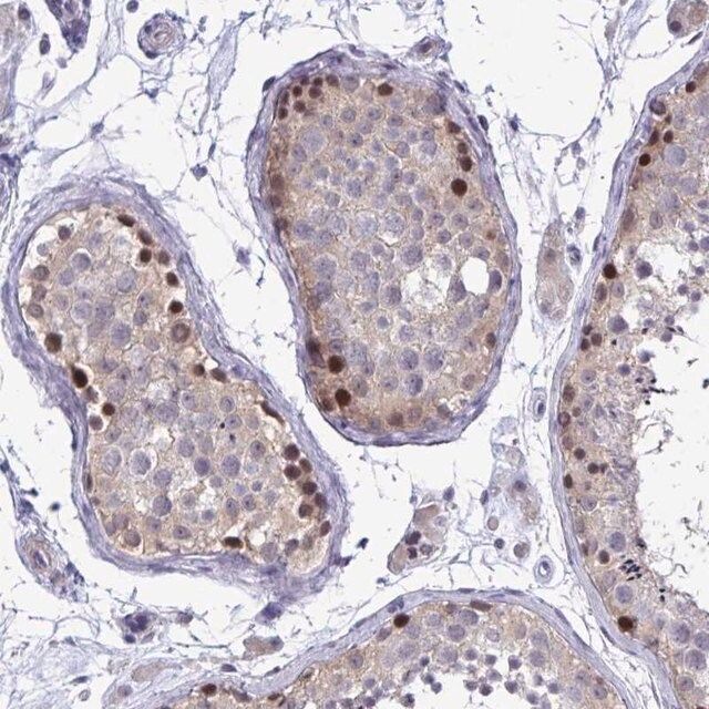 Anti-ZBTB25 antibody produced in rabbit