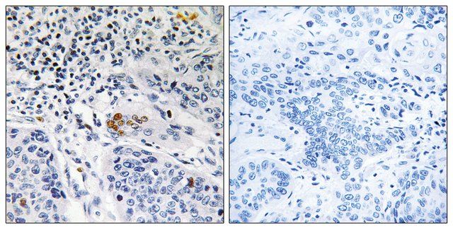 Anti-ZBTB40 antibody produced in rabbit