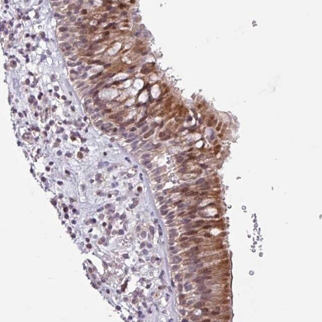 Anti-ZCCHC5 antibody produced in rabbit