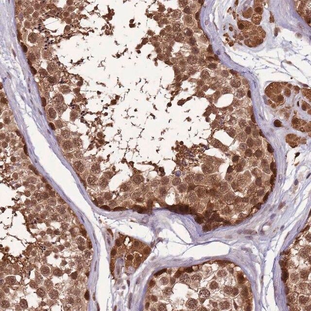 Anti-ZBTB5 antibody produced in rabbit