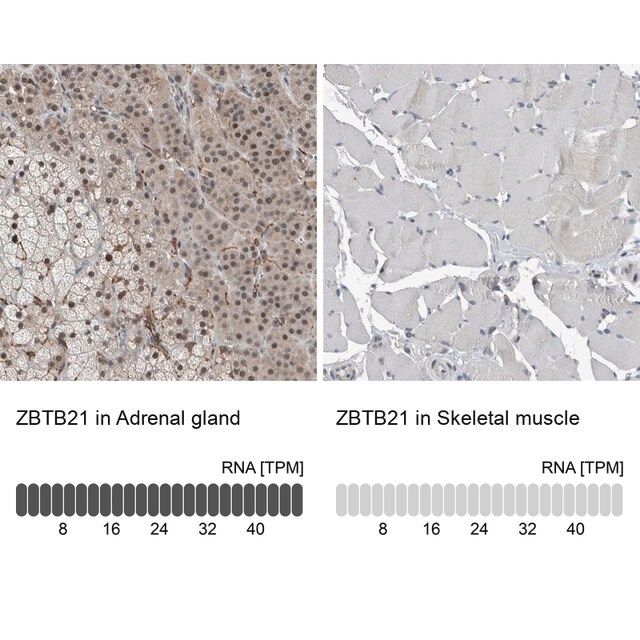 Anti-ZBTB21 antibody produced in rabbit