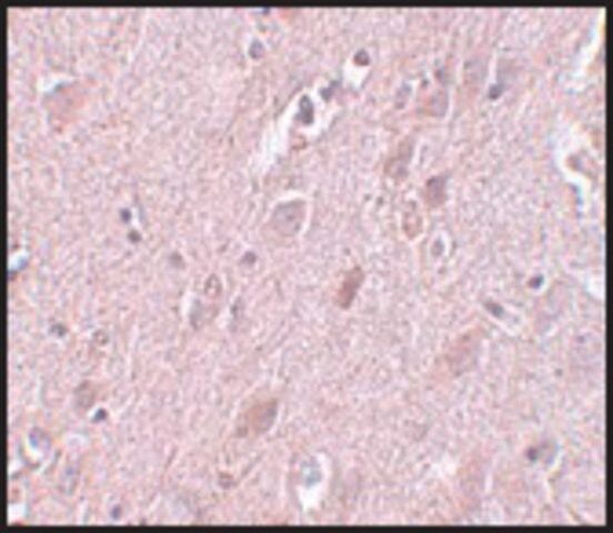 Anti-ZC3H12B antibody produced in rabbit