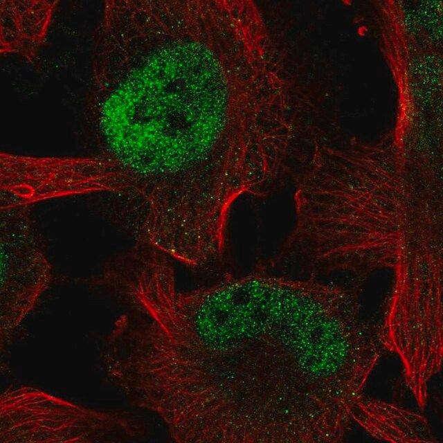 Anti-ZBTB38 antibody produced in rabbit