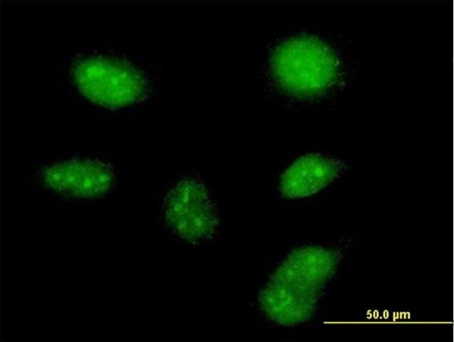 Anti-ZCCHC13 antibody produced in mouse