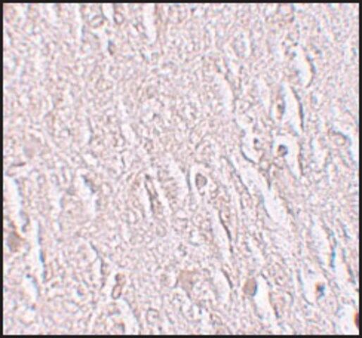 Anti-ZBTB5 antibody produced in rabbit