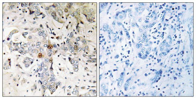 Anti-ZCCHC17 antibody produced in rabbit