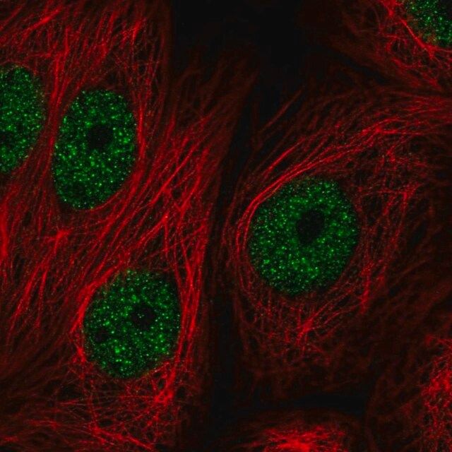 Anti-ZBTB21 antibody produced in rabbit