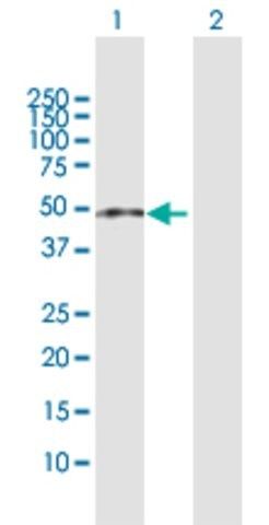 Anti-ZCCHC11 antibody produced in rabbit