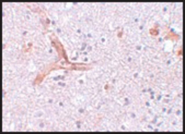 Anti-ZC3H12C antibody produced in rabbit