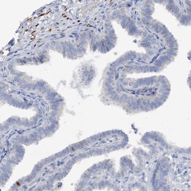 Anti-ZCCHC12 antibody produced in rabbit