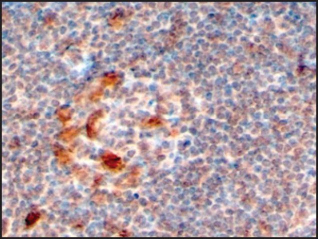 Anti-ZCCHC11 (C-terminal) antibody produced in goat