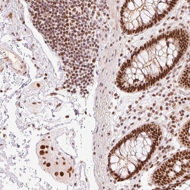 Anti-ZBTB44 antibody produced in rabbit