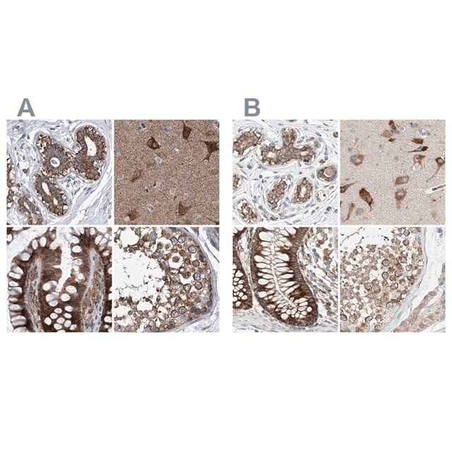 Anti-ZC3H15 antibody produced in rabbit