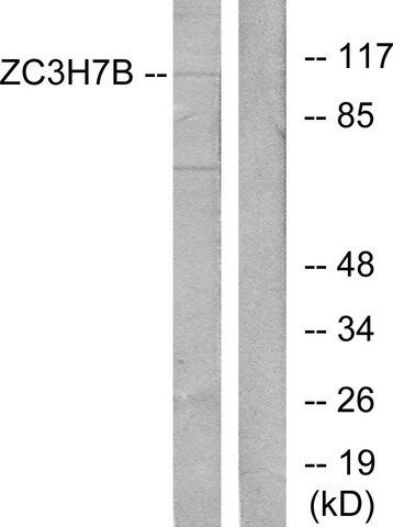 Anti-ZC3H7B antibody produced in rabbit