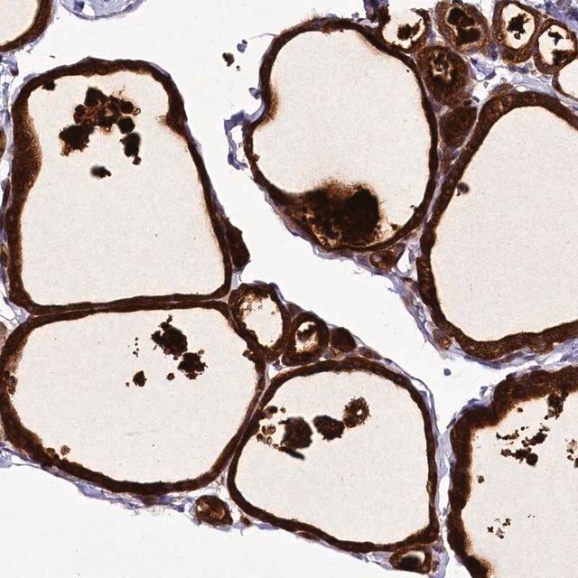 Anti-ZC3H12C antibody produced in rabbit