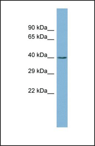 Anti-ZCCHC12 antibody produced in rabbit