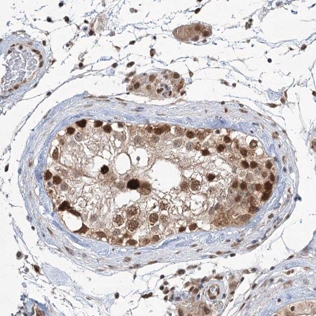 Anti-ZCCHC8 antibody produced in rabbit