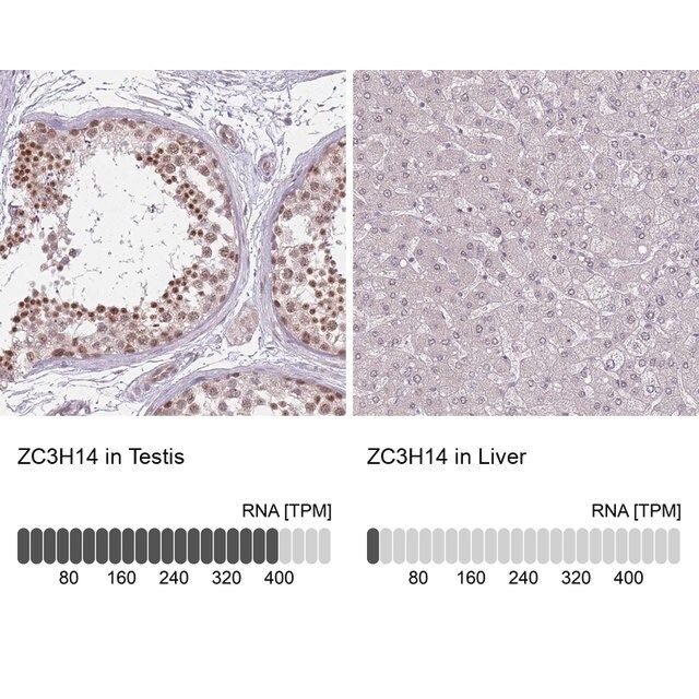 Anti-ZC3H14 antibody produced in rabbit