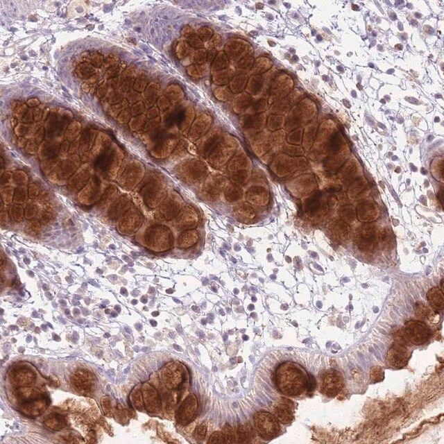 Anti-ZDHHC2 antibody produced in rabbit