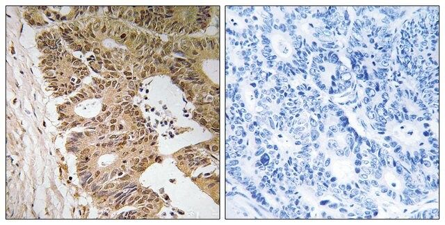 Anti-ZC3H8 antibody produced in rabbit