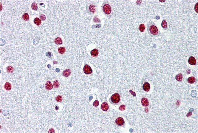 Anti-TUB (ab2) antibody produced in rabbit