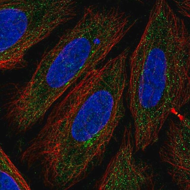 Anti-TTPAL antibody produced in rabbit