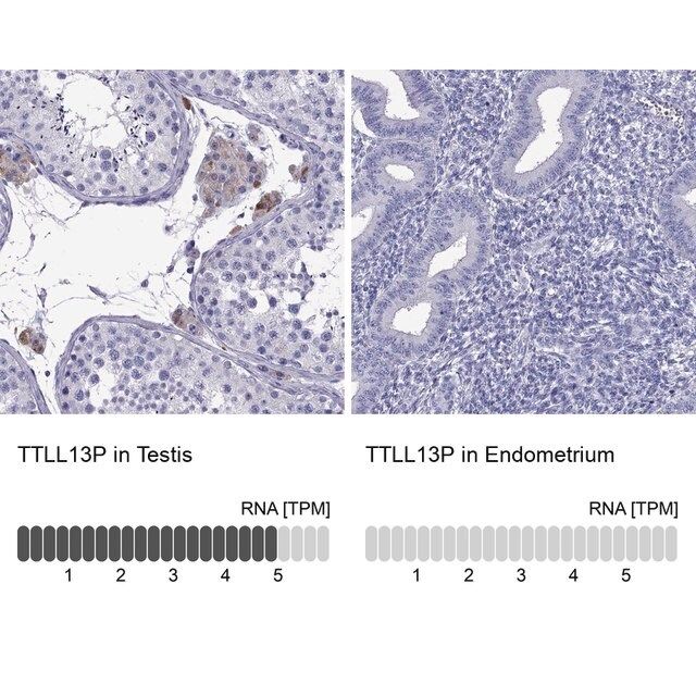 Anti-TTLL13P antibody produced in rabbit