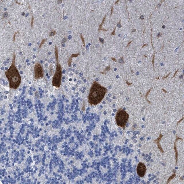 Anti-TUB antibody produced in rabbit