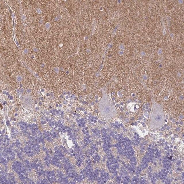 Anti-TTYH1 antibody produced in rabbit