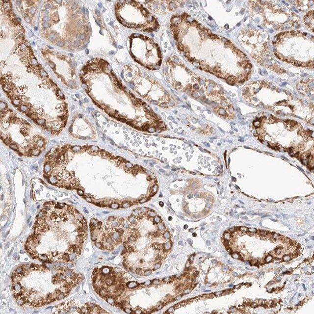 Anti-TTLL8 antibody produced in rabbit