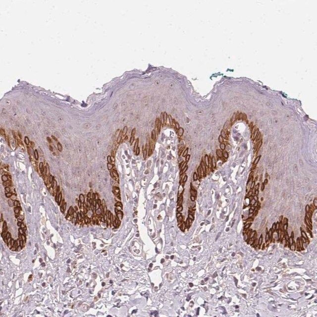 Anti-TUB antibody produced in rabbit