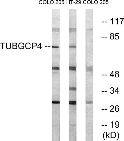 Anti-TUBGCP4 antibody produced in rabbit