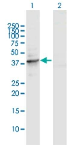 Anti-TUBD1 antibody produced in rabbit