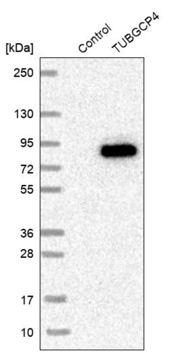 Anti-TUBGCP4 antibody produced in rabbit