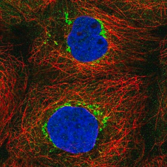 Anti-TVP23C antibody produced in rabbit