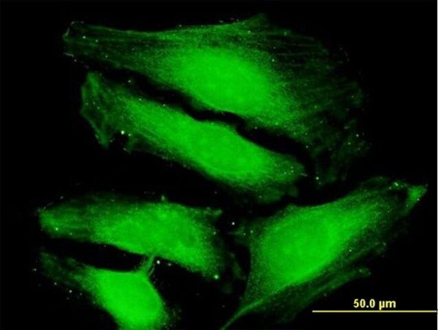 Anti-TUSC4 antibody produced in mouse